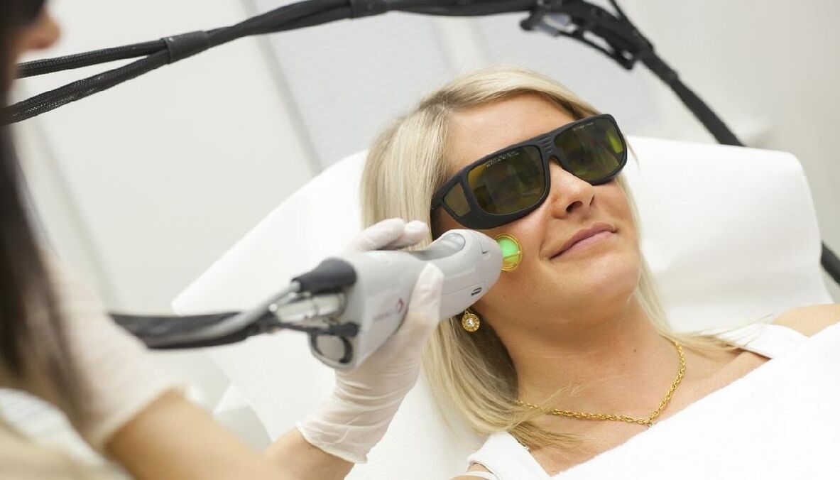 Odmładzanie laserowe