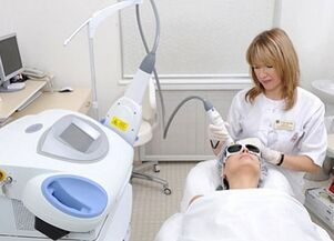wady i zalety frakcyjnego odmładzania skóry twarzy laserem